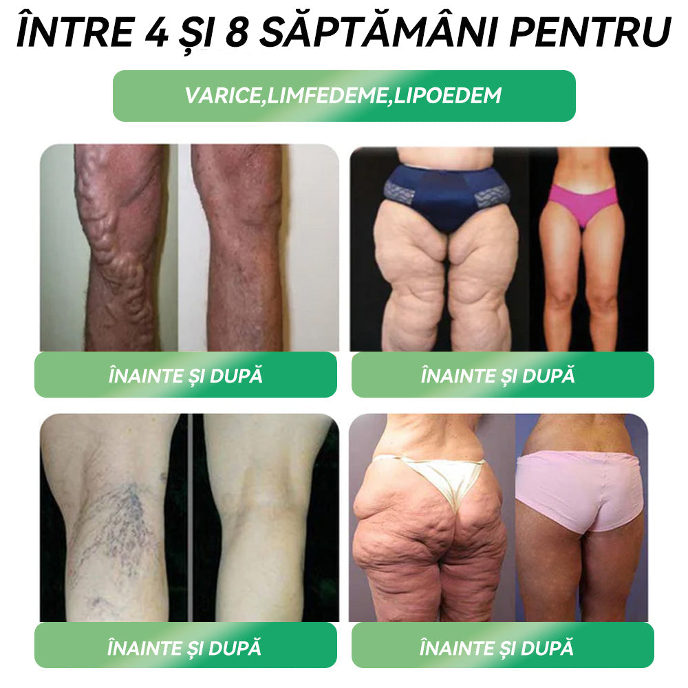 🌟Au mai rămas doar 5 cutii! Prinde acum reducerea de 50%! Recâștigă-ți silueta și sănătatea! Dacă ratezi această șansă acum, anul viitor poate fi prea târziu! 💥🔥